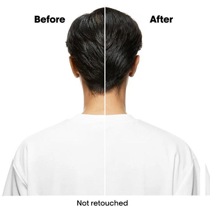 L'Oreal L'oreal Professionnel Serie Expert Advanced Scalp Anti Oiliness Mask 250ml